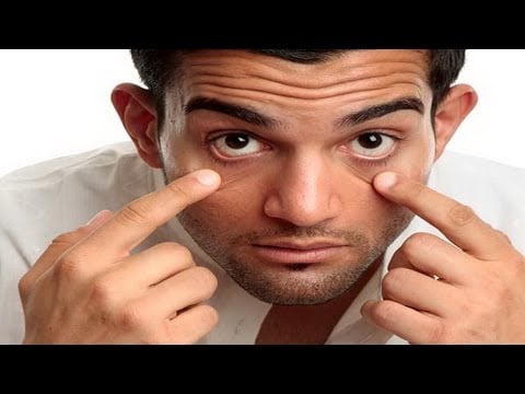 7 Simple Ways To Prevent Dry Eyes That You Must Try!