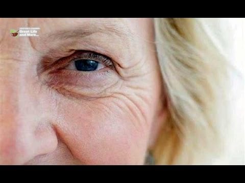 MESSENGERS OF SERIOUS PROBLEMS WHAT DO WRINKLES SAY ABOUT YOUR HEALTH