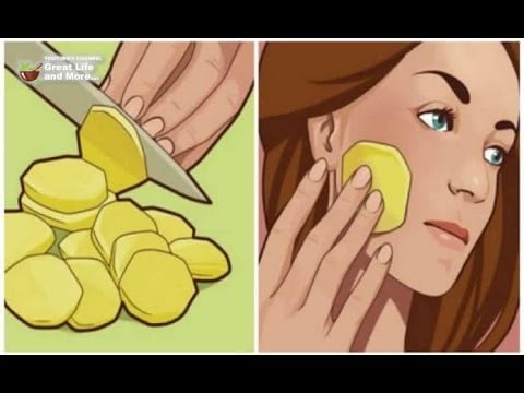 NATURAL SOLUTIONS FOR DARK SPOTS, UNEVEN SKIN TONE AND HYPERPIGMENTATION